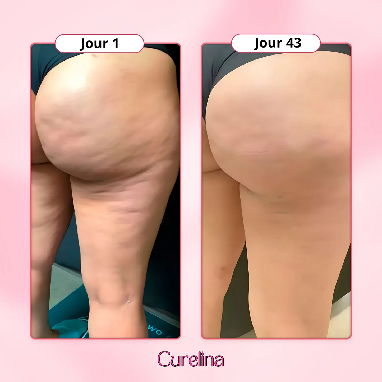 Huile raffermissant anti-cellulite Curelina™