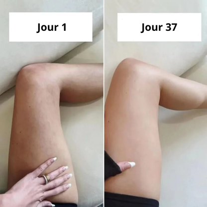 Huile raffermissant anti-cellulite Curelina™