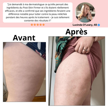 Kit anti-cellulite Curelina™