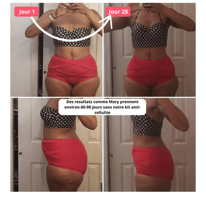 Kit anti-cellulite Curelina™